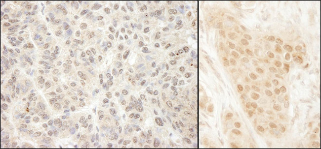 MCAK Antibody in Immunohistochemistry (Paraffin) (IHC (P))