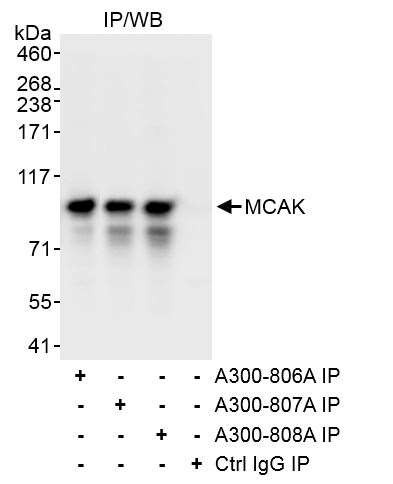 MCAK Antibody in Immunoprecipitation (IP)