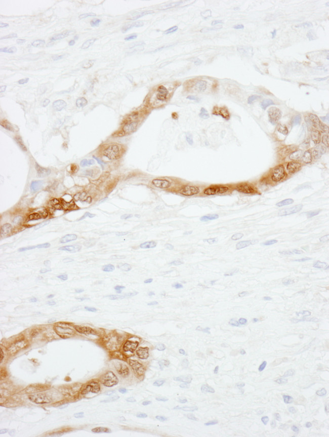 CRABP2 Antibody in Immunohistochemistry (Paraffin) (IHC (P))