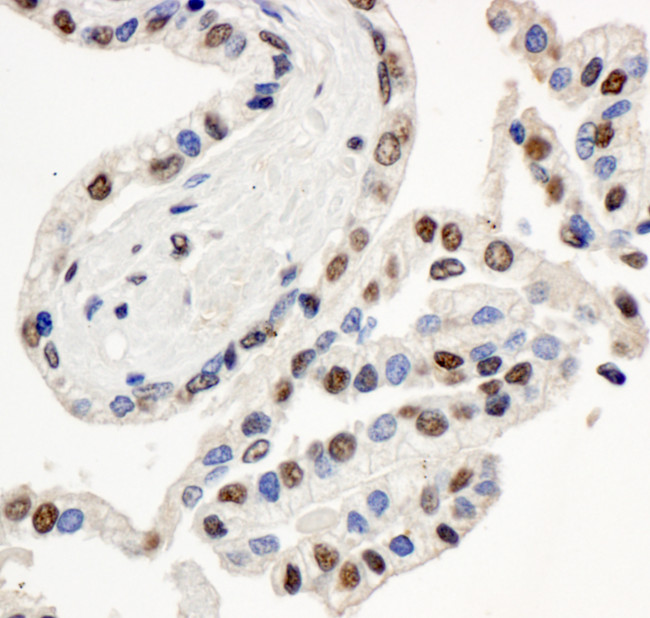 BAF57/SMARCE1 Antibody in Immunohistochemistry (Paraffin) (IHC (P))