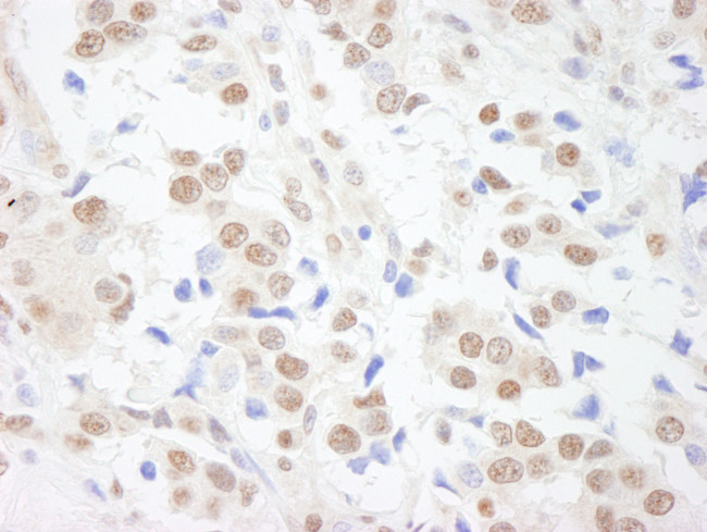 SAFB1 Antibody in Immunohistochemistry (Paraffin) (IHC (P))