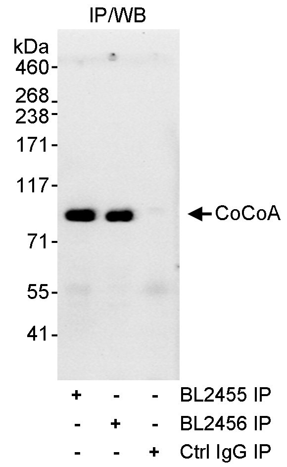 CoCoA Antibody in Immunoprecipitation (IP)