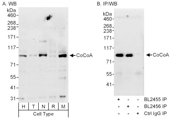 CoCoA Antibody in Western Blot (WB)