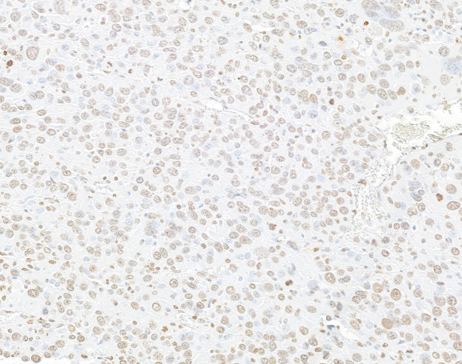 Histone H3 Antibody in Immunohistochemistry (Paraffin) (IHC (P))