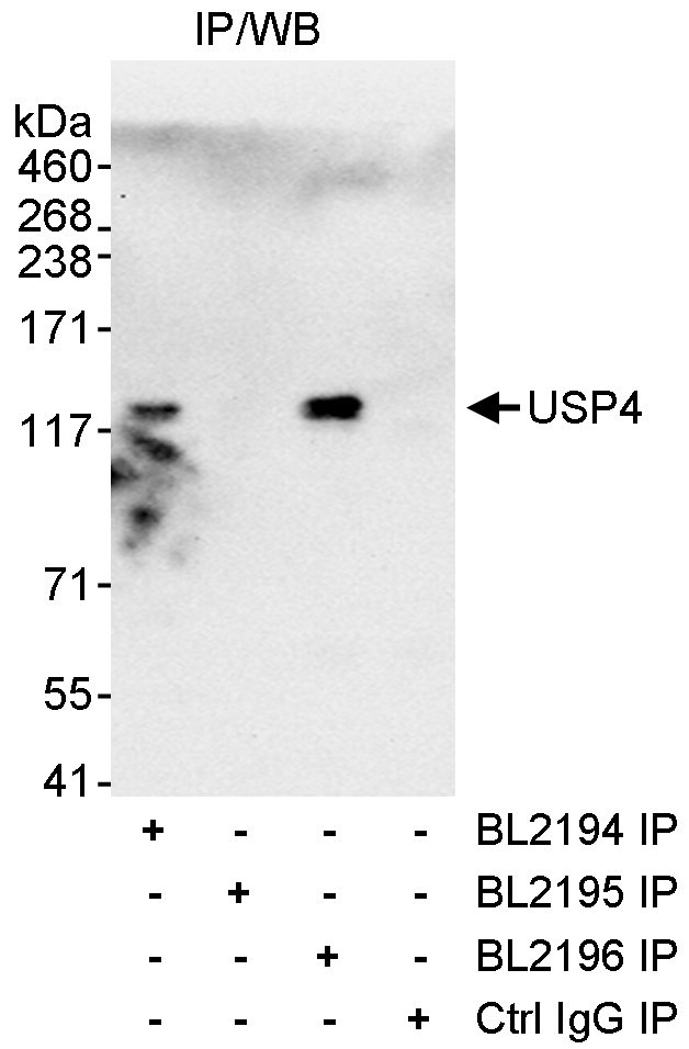 USP4 Antibody in Immunoprecipitation (IP)