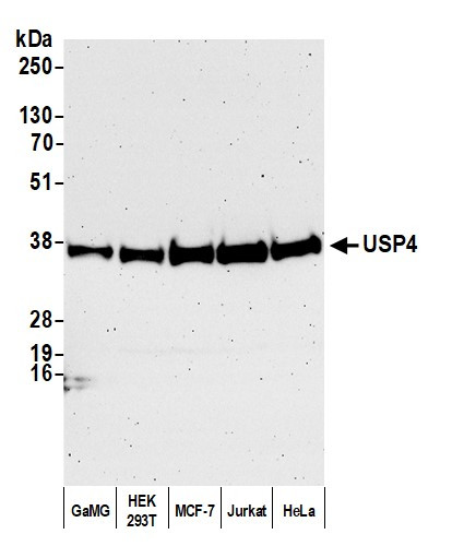 USP4 Antibody in Western Blot (WB)
