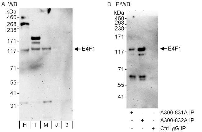 E4F1 Antibody in Western Blot (WB)
