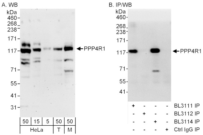 PPP4R1 Antibody in Western Blot (WB)