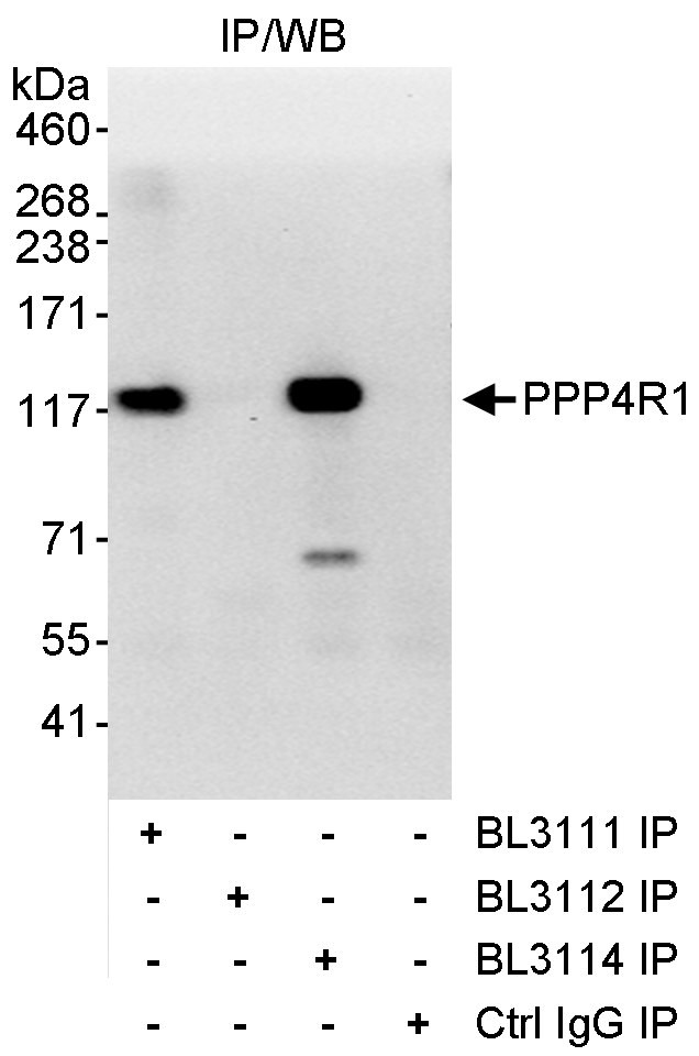 PPP4R1 Antibody in Immunoprecipitation (IP)