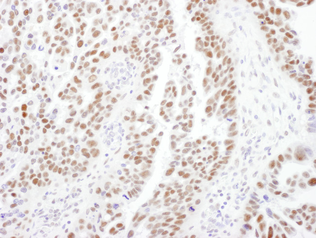 PPP4R2 Antibody in Immunohistochemistry (Paraffin) (IHC (P))