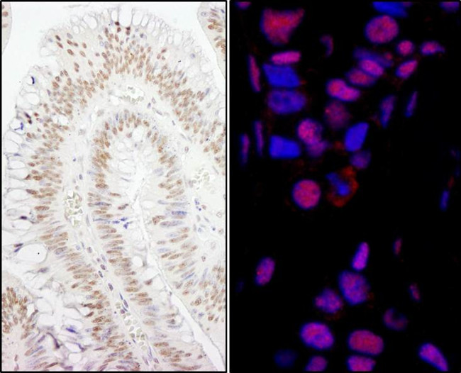 PPP4R3 Alpha Antibody in Immunohistochemistry (Paraffin) (IHC (P))