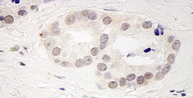 PPP4R3 Beta Antibody in Immunohistochemistry (Paraffin) (IHC (P))