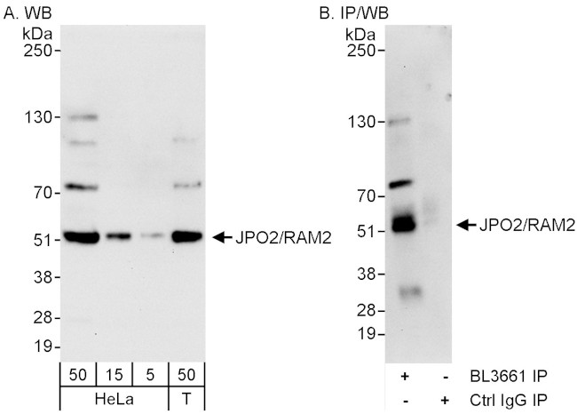 JPO2/RAM2 Antibody in Western Blot (WB)