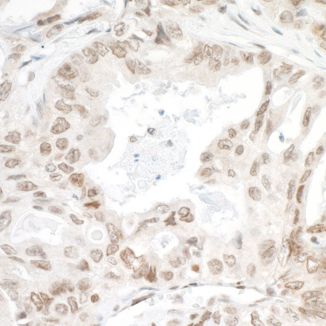 LEDGF/p75 Antibody in Immunohistochemistry (Paraffin) (IHC (P))