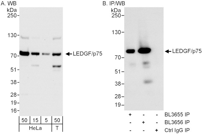 LEDGF/p75 Antibody in Western Blot (WB)