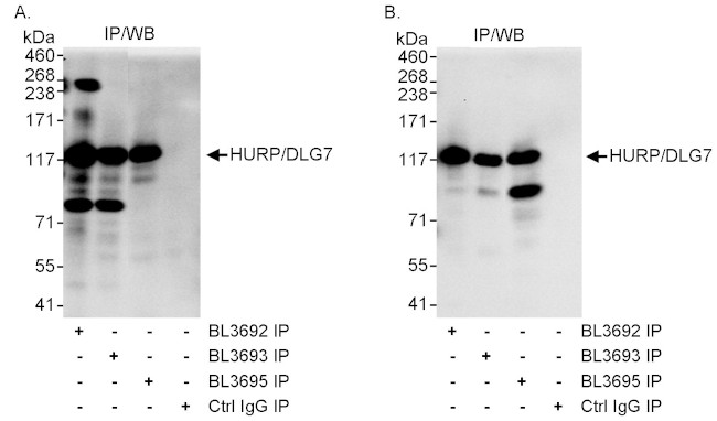 HURP/DLG7 Antibody in Immunoprecipitation (IP)