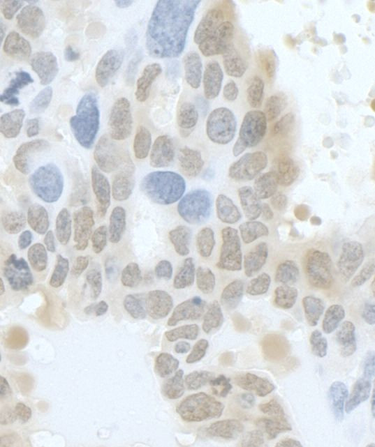 HURP/DLG7 Antibody in Immunohistochemistry (Paraffin) (IHC (P))