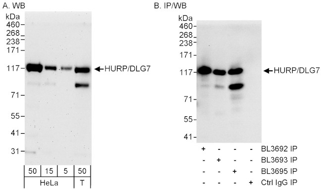 HURP/DLG7 Antibody in Western Blot (WB)