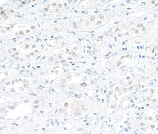 DHX9 Antibody in Immunohistochemistry (Paraffin) (IHC (P))