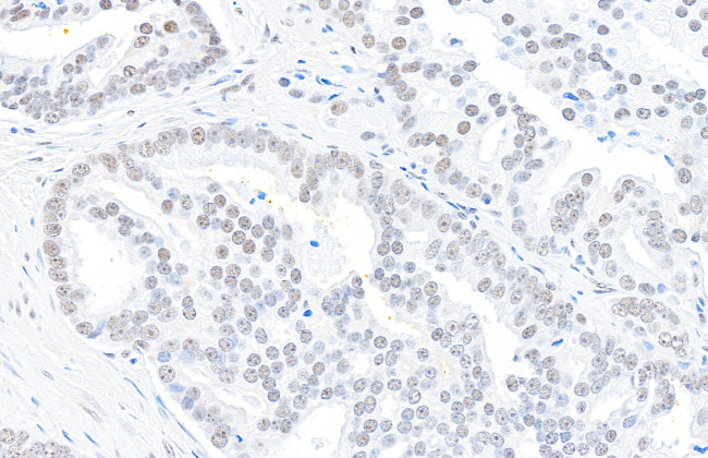DHX9 Antibody in Immunohistochemistry (Paraffin) (IHC (P))