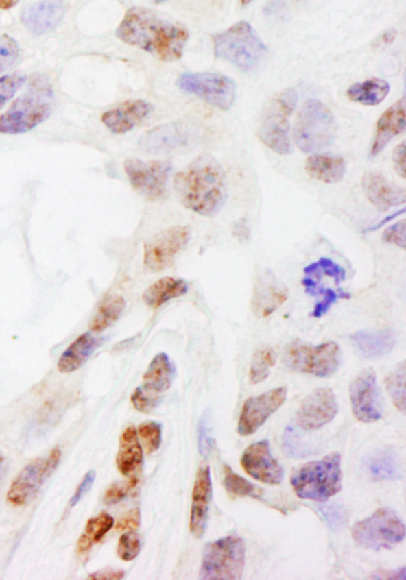 DHX38 Antibody in Immunohistochemistry (Paraffin) (IHC (P))