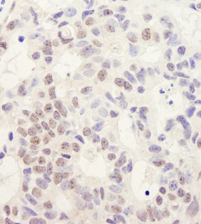 DHX38 Antibody in Immunohistochemistry (Paraffin) (IHC (P))