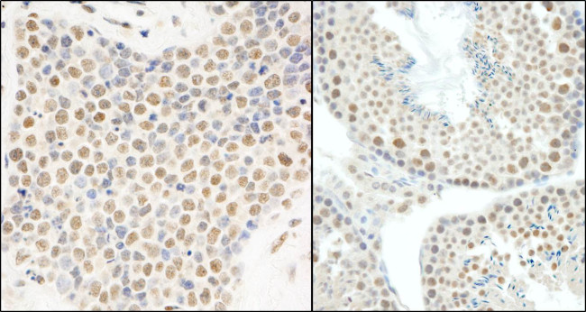 E1B-AP5 Antibody in Immunohistochemistry (Paraffin) (IHC (P))