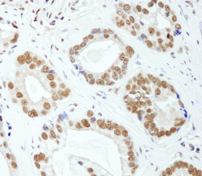E1B-AP5 Antibody in Immunohistochemistry (Paraffin) (IHC (P))