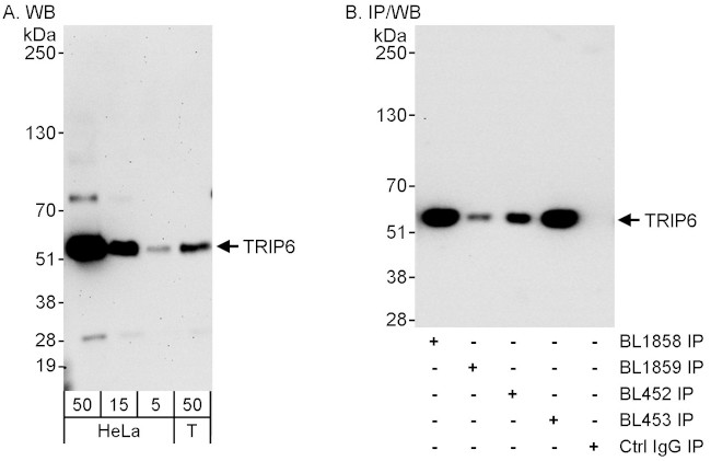 TRIP6 Antibody in Western Blot (WB)