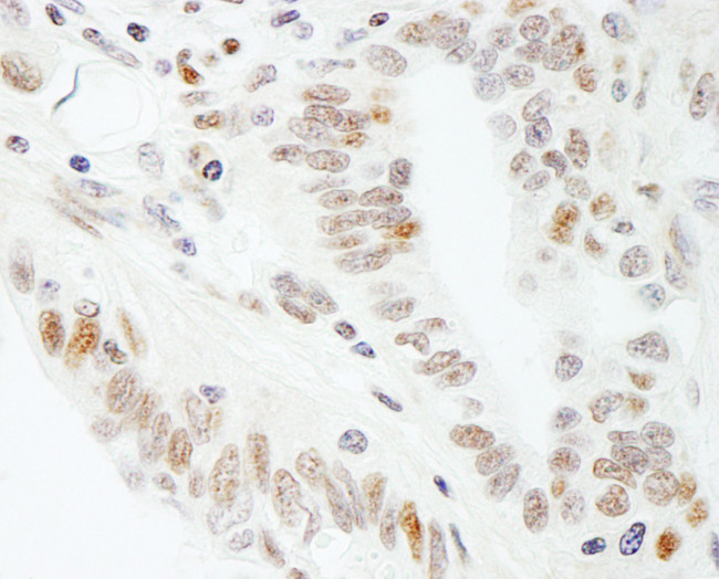 SUPT5H Antibody in Immunohistochemistry (Paraffin) (IHC (P))