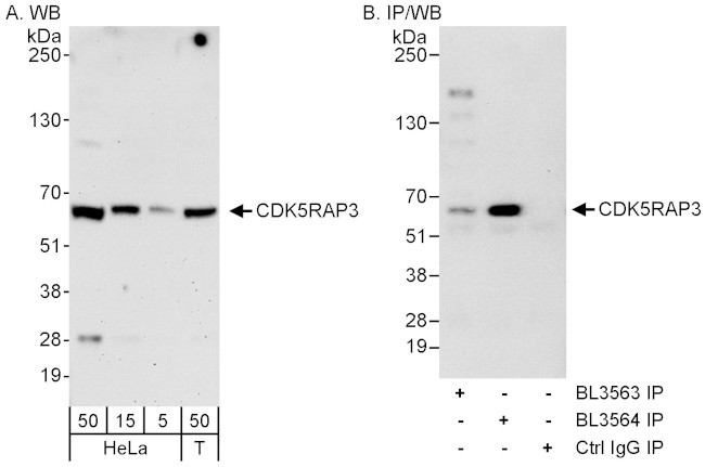 CDK5RAP3 Antibody in Western Blot (WB)