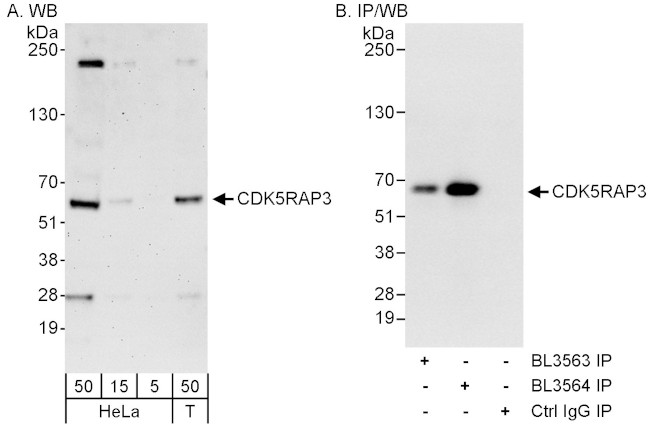 CDK5RAP3 Antibody in Western Blot (WB)