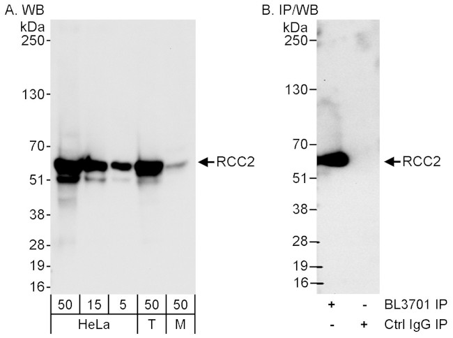 RCC2 Antibody in Western Blot (WB)