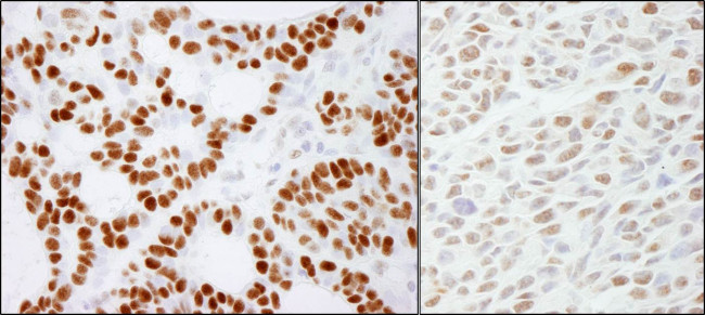 RCC2 Antibody in Immunohistochemistry (Paraffin) (IHC (P))