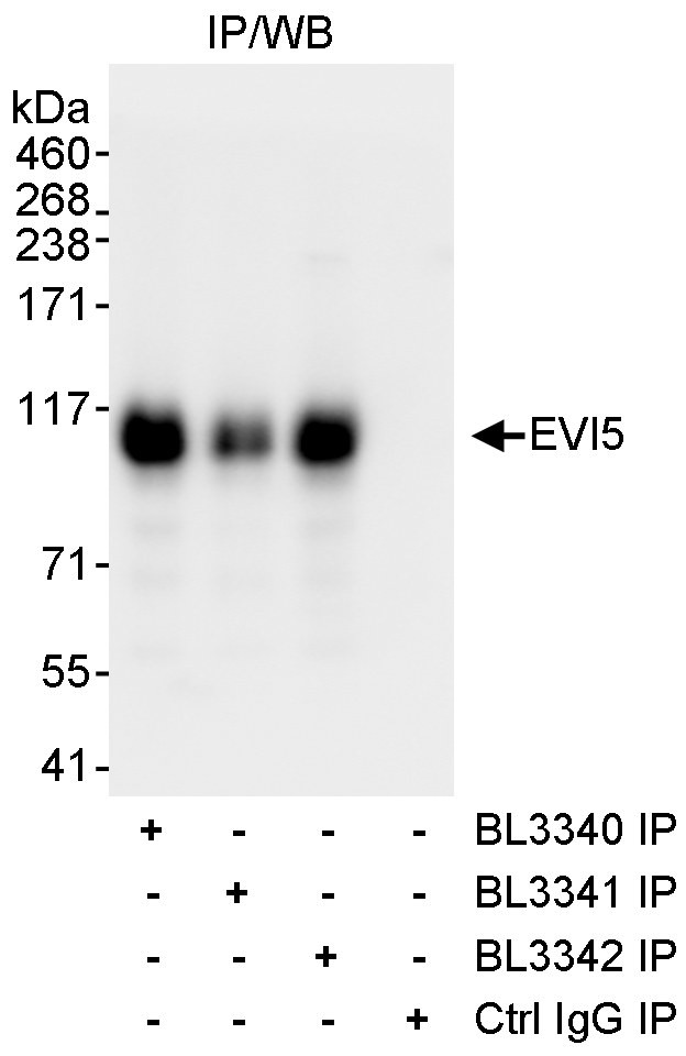 EVI5 Antibody in Immunoprecipitation (IP)