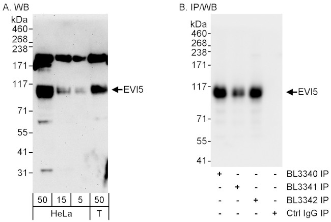 EVI5 Antibody in Western Blot (WB)