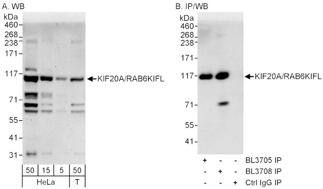 KIF20A/RAB6KIFL Antibody in Western Blot (WB)