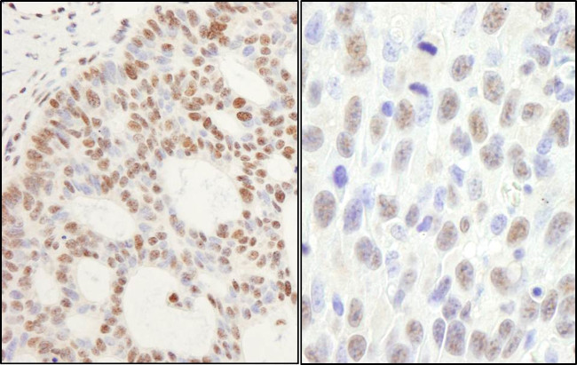 PPM1G Antibody in Immunohistochemistry (Paraffin) (IHC (P))
