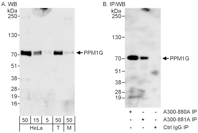 PPM1G Antibody in Western Blot (WB)