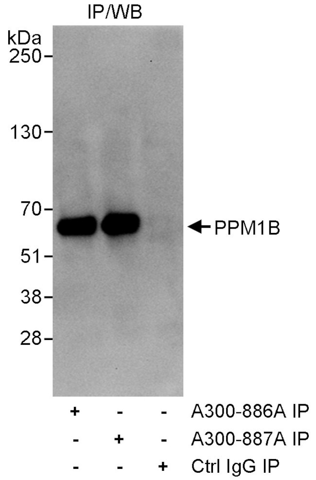 PPM1B Antibody in Immunoprecipitation (IP)