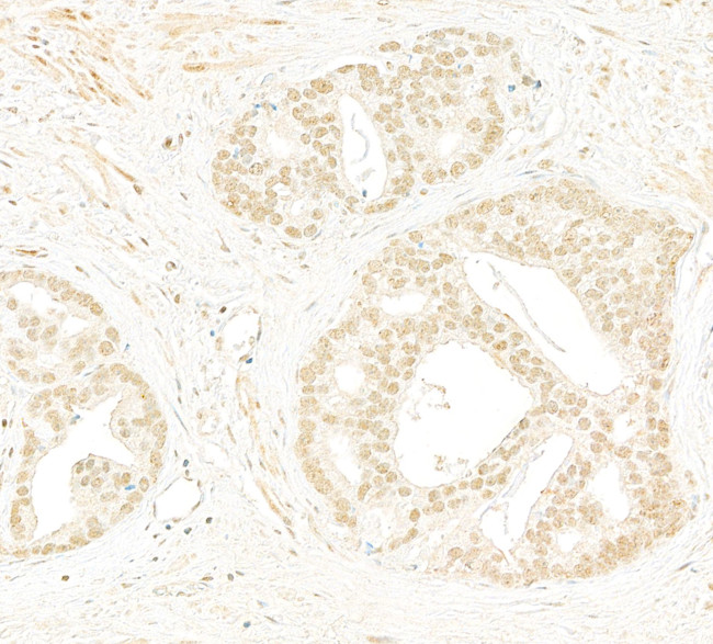 Rad9 Antibody in Immunohistochemistry (Paraffin) (IHC (P))