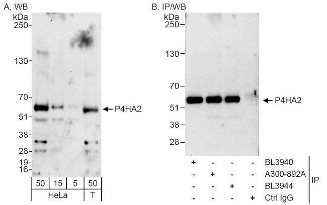 P4HA2 Antibody in Western Blot (WB)