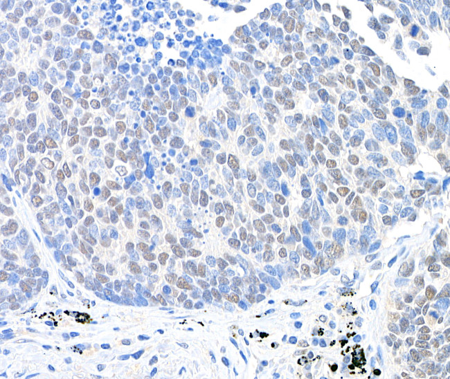 USP28 Antibody in Immunohistochemistry (Paraffin) (IHC (P))