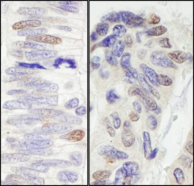 Pescadillo Antibody in Immunohistochemistry (Paraffin) (IHC (P))