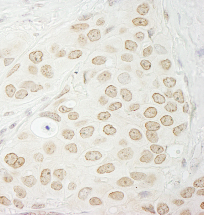 PPP1CC Antibody in Immunohistochemistry (Paraffin) (IHC (P))