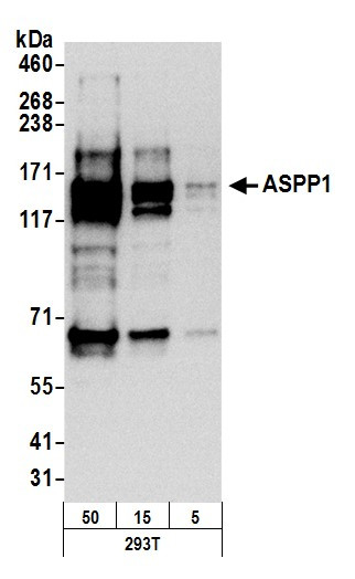 ASPP1 Antibody in Western Blot (WB)