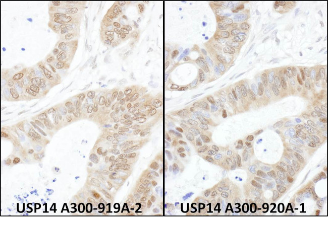 USP14 Antibody in Immunohistochemistry (Paraffin) (IHC (P))