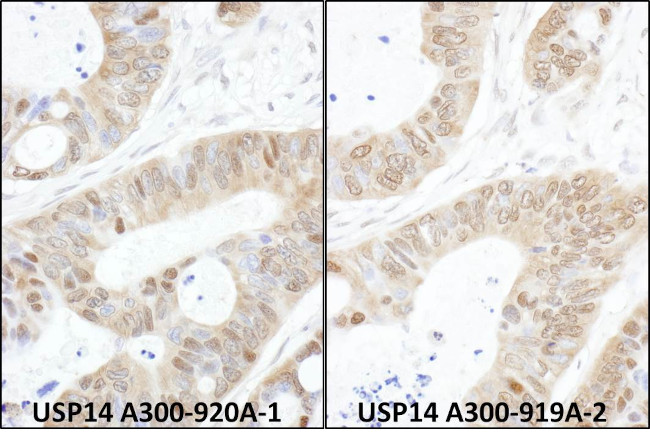 USP14 Antibody in Immunohistochemistry (Paraffin) (IHC (P))