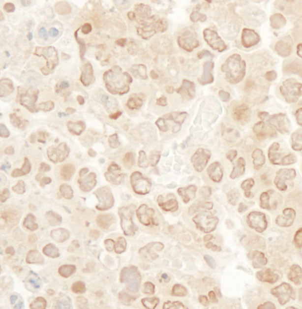 MCAK Antibody in Immunohistochemistry (Paraffin) (IHC (P))