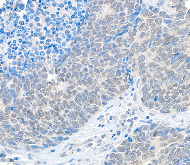USP37 Antibody in Immunohistochemistry (Paraffin) (IHC (P))